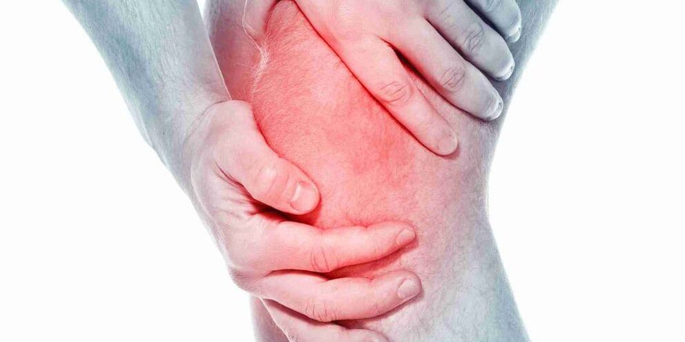 Pain in a bent or straight knee is a symptom of arthrosis of the knee joint