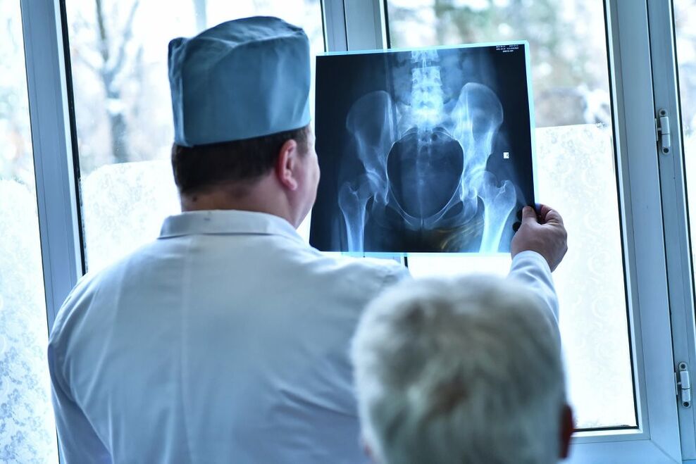 The doctor looks at a picture of a hip joint with arthrosis