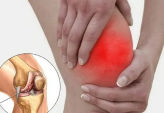 What happens when arthritis